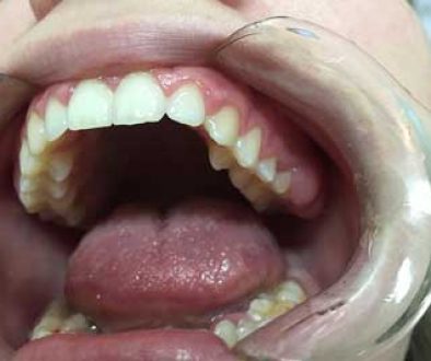 dentist-teeth