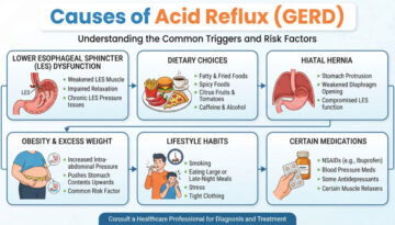 causes of acid reflux